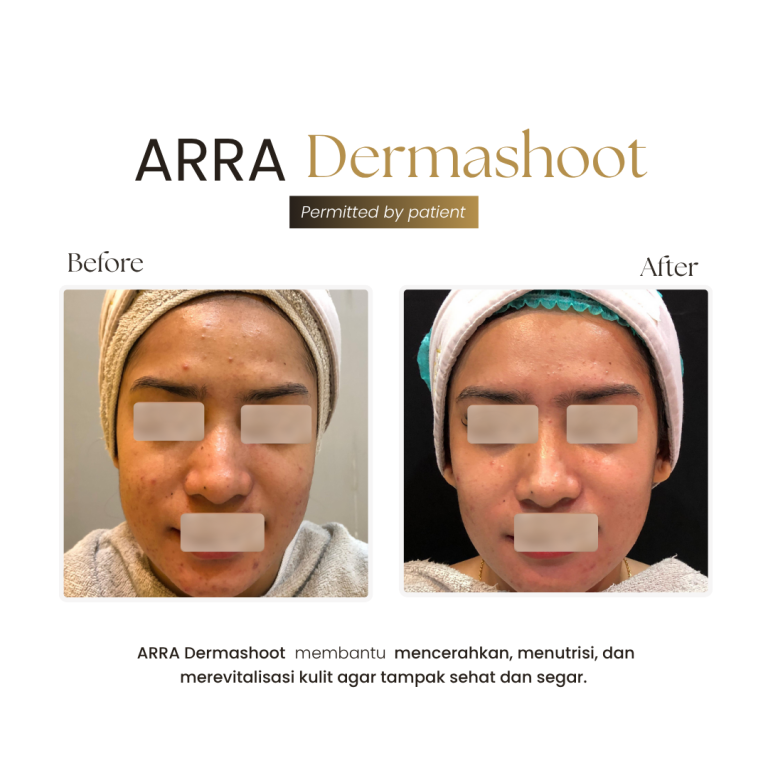Dermashoot