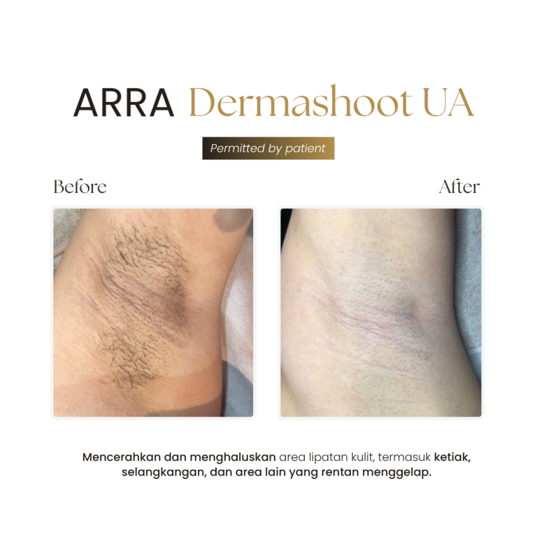 Dermashoot UA