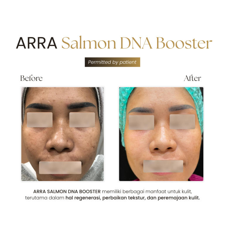 Salmon DNA Booster